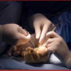 Microvascular surgery